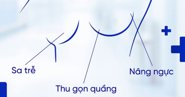 BẠN ĐÃ BIẾT Đúng CÁC LỖI SAI KHI CHĂM SÓC VẾT SẸO SÂU SAU NÂNG NGỰC CHƯA?